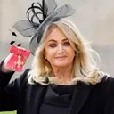 Bonnie Tyler Undergoes Emergency Surgery in Portugal