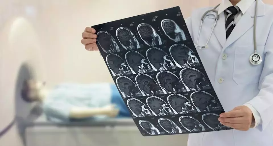 NeurAxis (NRXS) Shares Rise Amid Favorable Reimbursement & Guideline Developments
