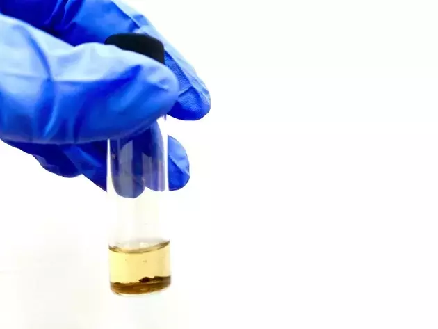 ADC Therapeutics: Downgraded to 'Sell' Amid ZYNLONTA Trial Setbacks
